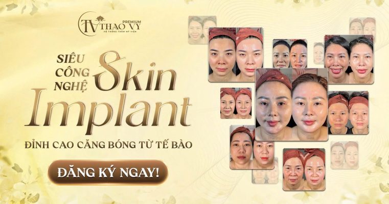 Căng bóng da Skin Implant tại Thẩm Mỹ Viện Thảo Vy giúp da ẩm mượt và rạng rỡ.