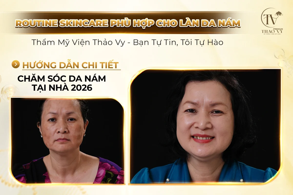 ROUTINE SKINCARE PHÙ HỢP CHO LÀN DA NÁM – HƯỚNG DẪN CHI TIẾT CHĂM SÓC DA NÁM TẠI NHÀ 2026